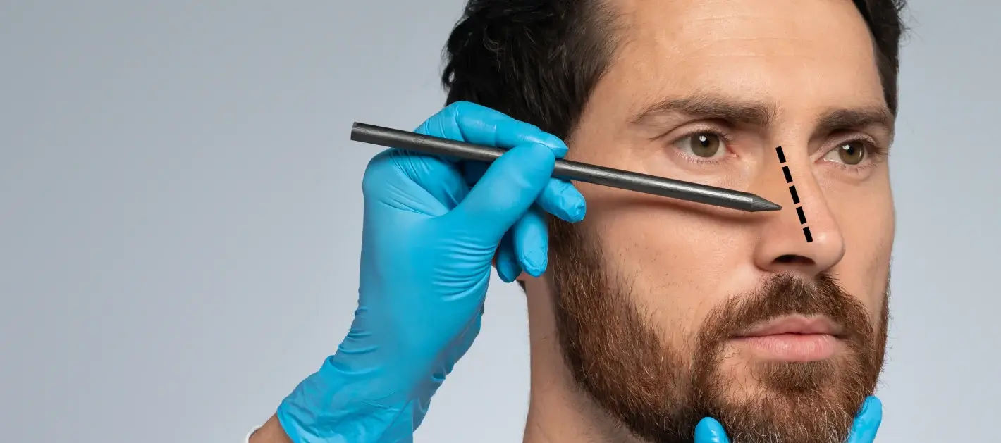 Rinoplastia en Colombia: Transforma tu apariencia con cirujanos de clase mundial