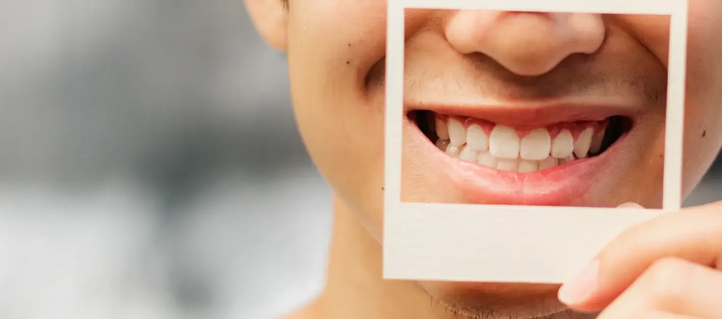 Smile Design in Barranquilla: Your Perfect Smile Starts Here